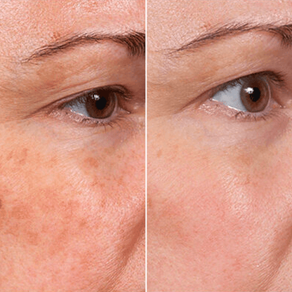 Rejuvenate Face Serum